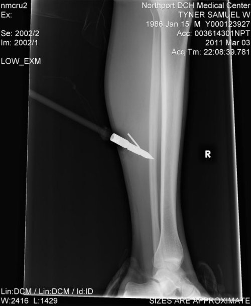 legg.jpg