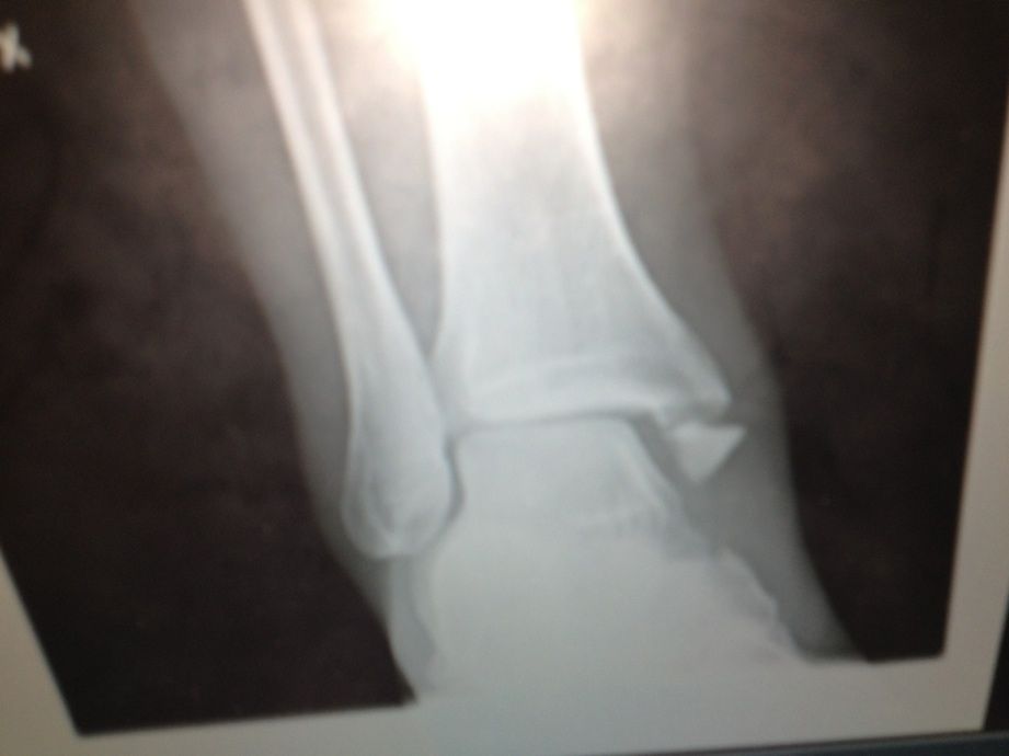 xray.jpg